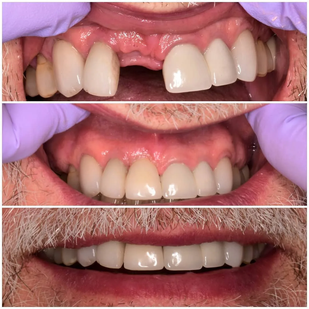 The Dental Method - Dentist of Dallas photo 2