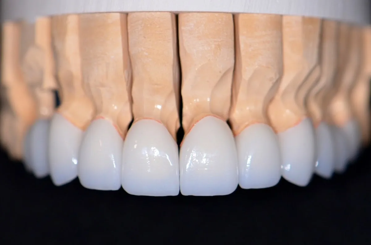 Smile Recreation Dentistry by Dr. Baseri photo 3