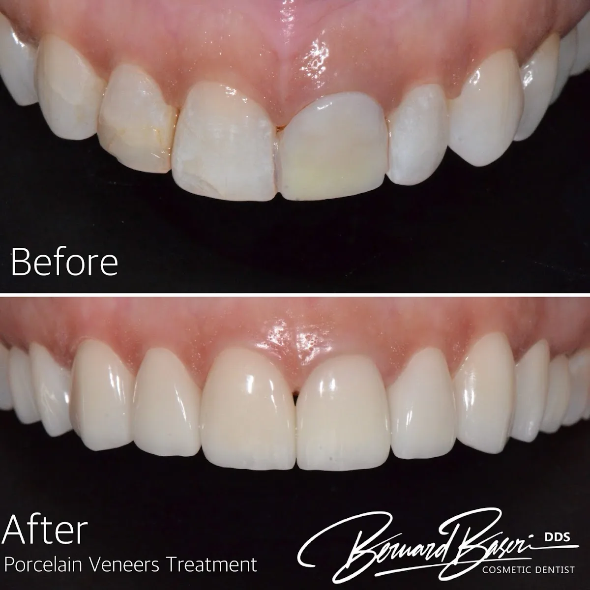 Smile Recreation Dentistry by Dr. Baseri photo 2