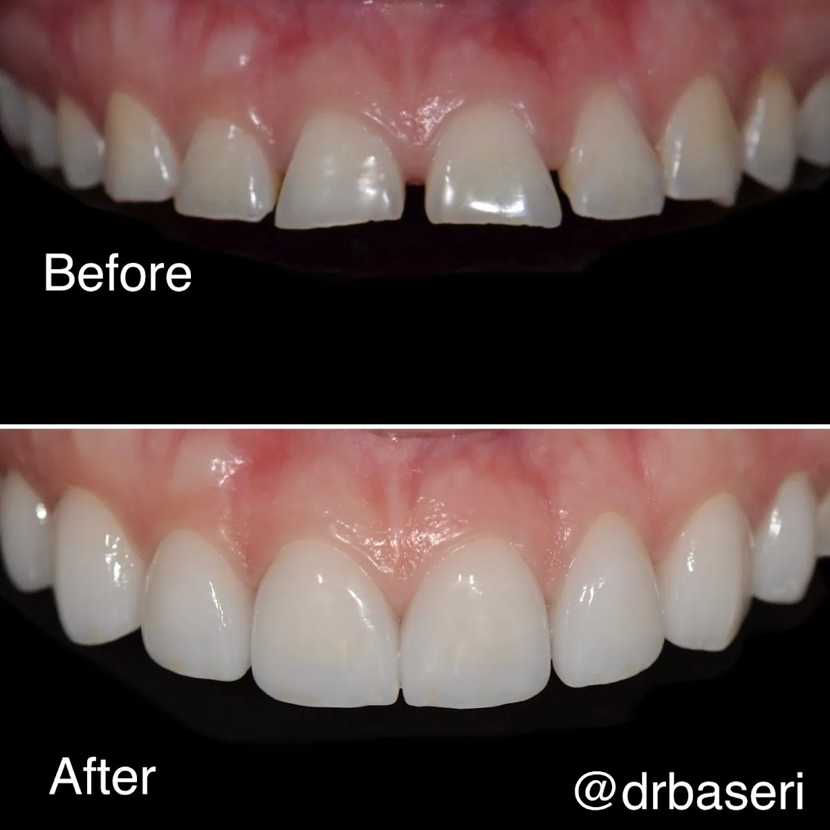 Smile Recreation Dentistry by Dr. Baseri photo 1