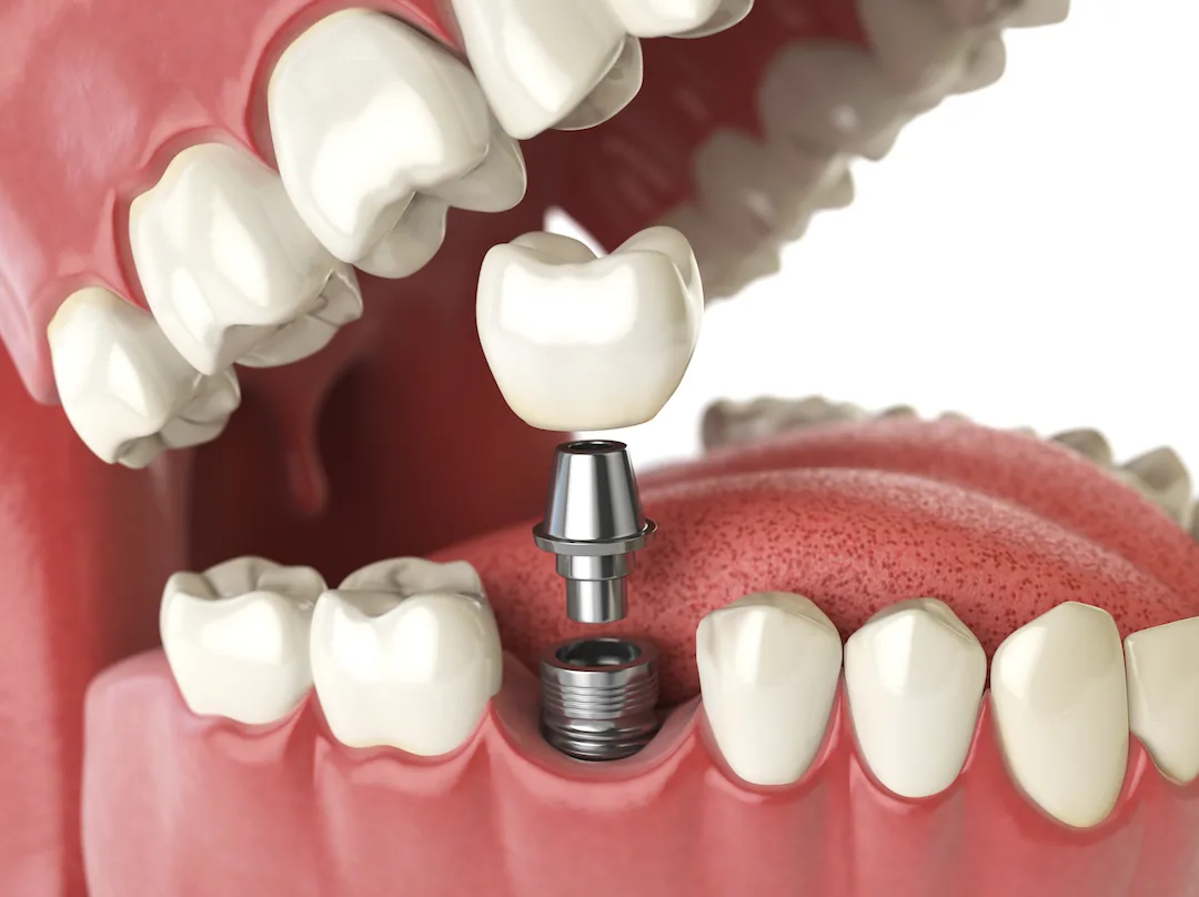 Mass Dental Associates