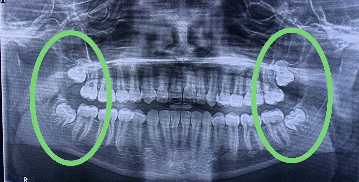 Dr. Johanny Caceres. Oral & Facial Surgery Of Miami photo 1