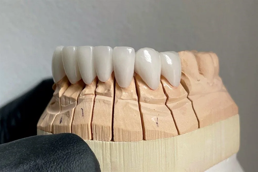 Park Slope Dental Aesthetics, Union Street - mediDental Group photo 3