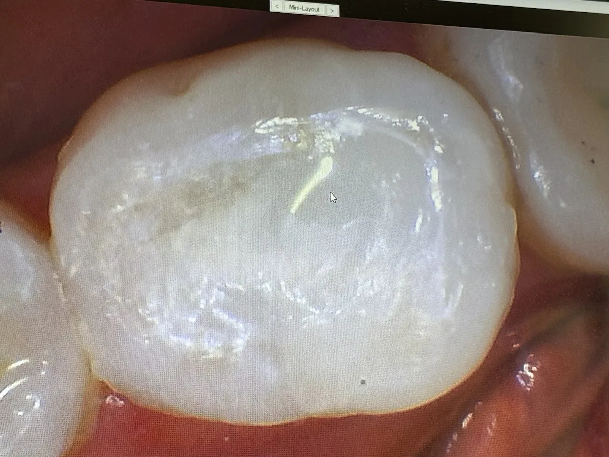 ValleyWide Dental photo 3