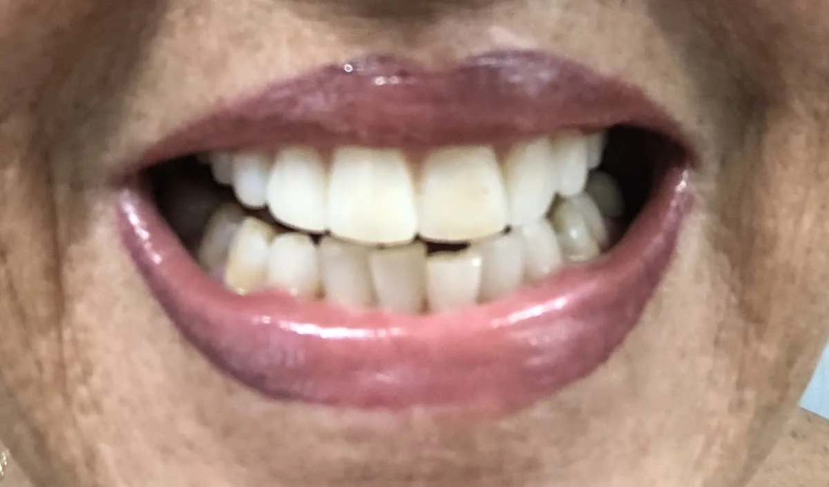 Family Dental Health of Spring Valley North photo 3