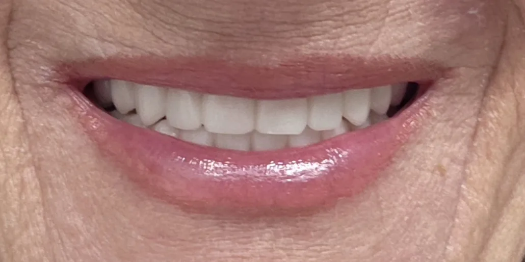 Michigan Dental Implant Studio