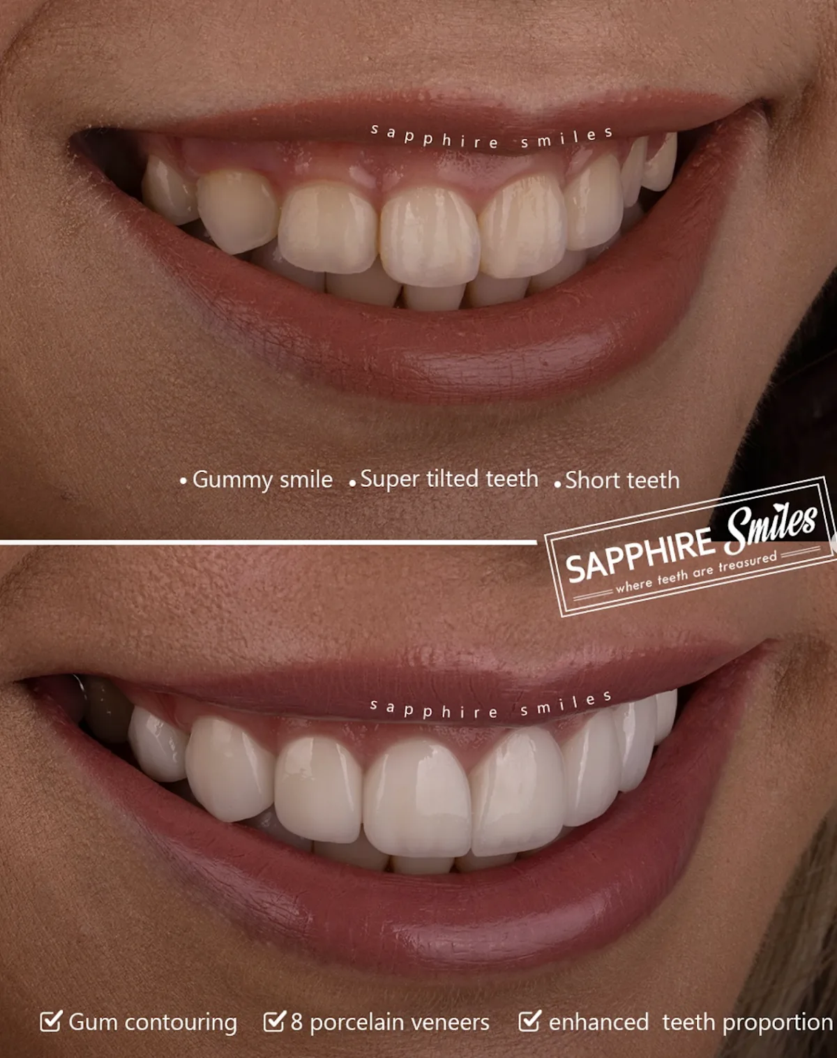 Sapphire Smiles - Dr. Antoun | Leading Cosmetic Dentist in Houston photo 3