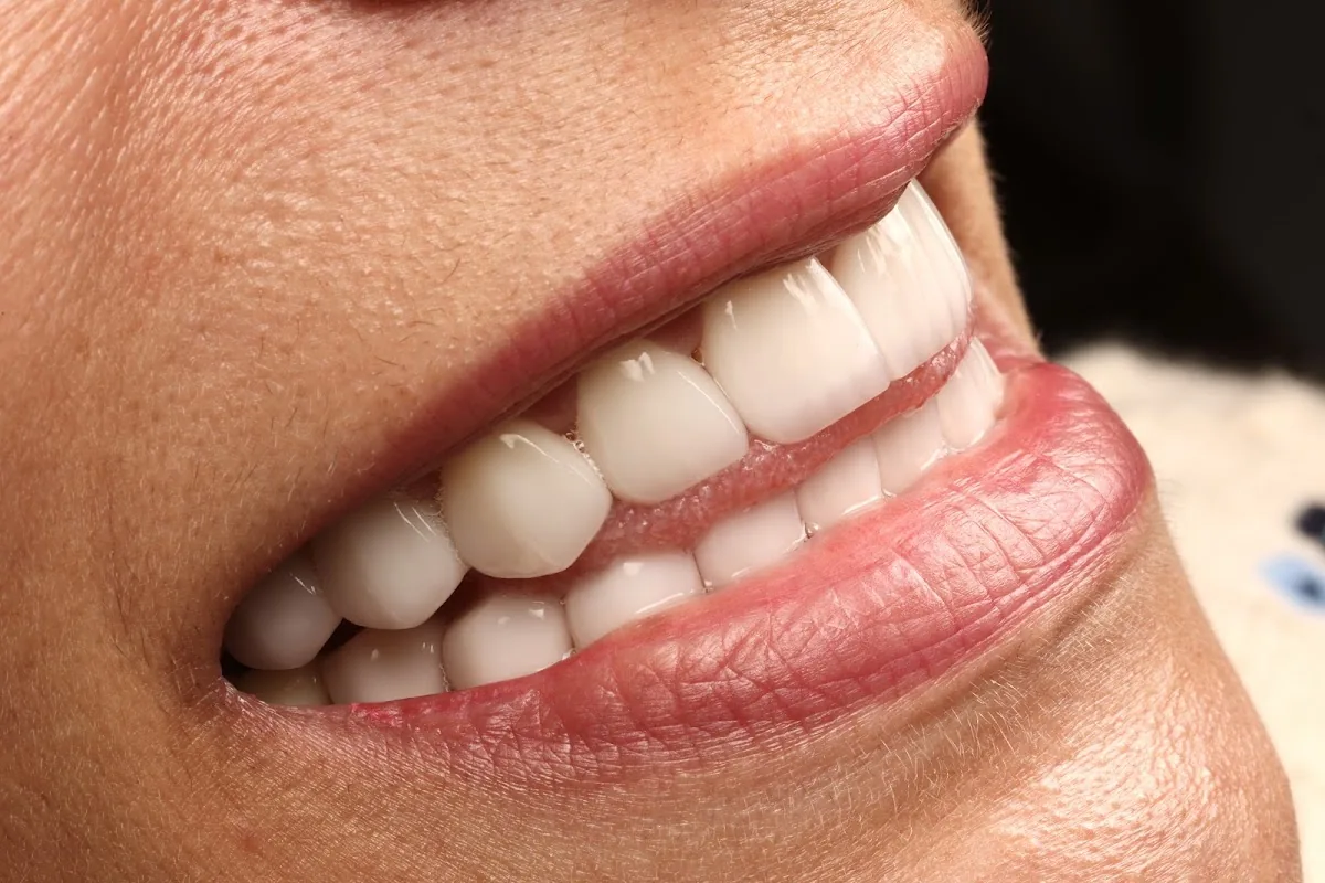 Sapphire Smiles - Dr. Antoun | Leading Cosmetic Dentist in Houston photo 2