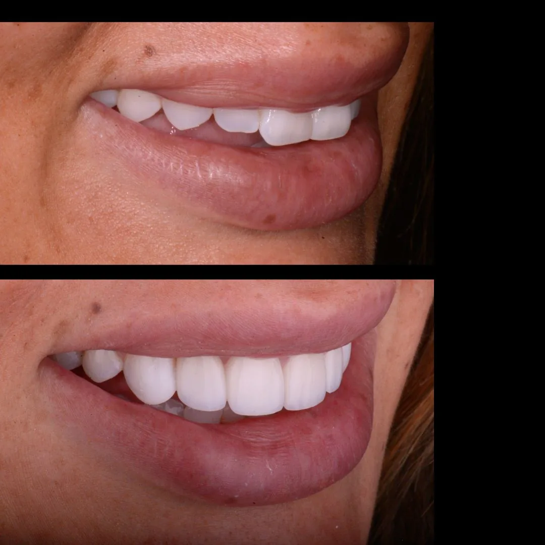 Envision Dental Spa | Arlington, Tx