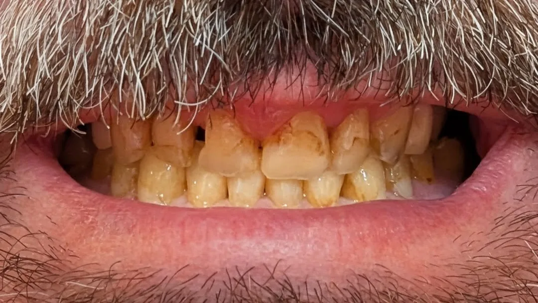 Warren Family Dentistry
