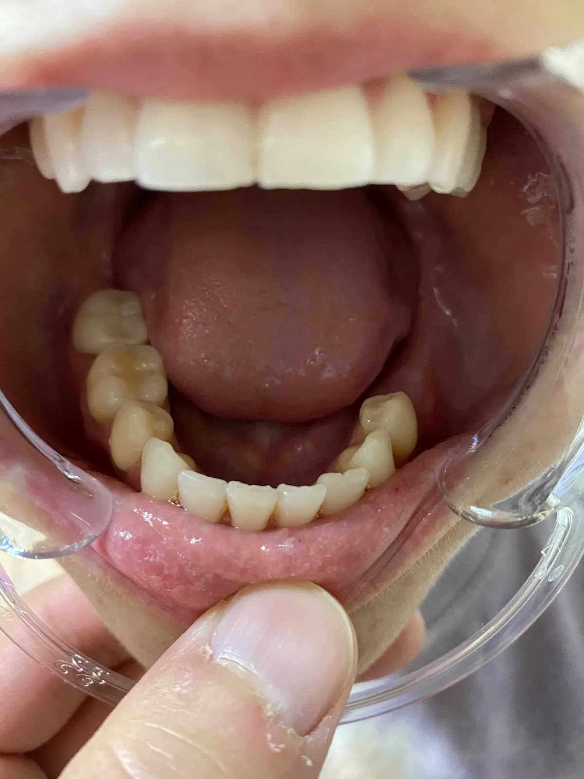 Monarch Dental photo 6