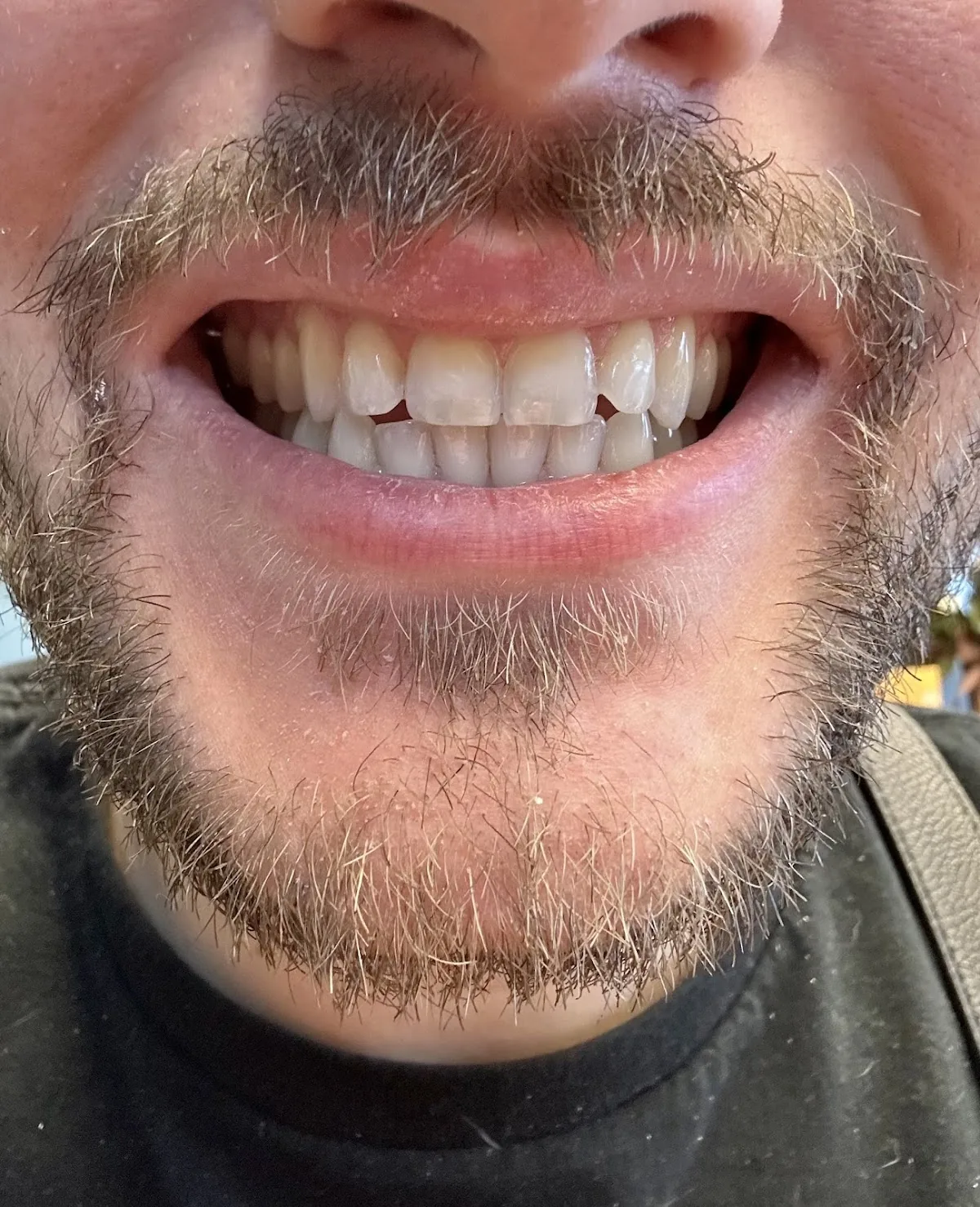 Arnold Family Dentistry photo 4