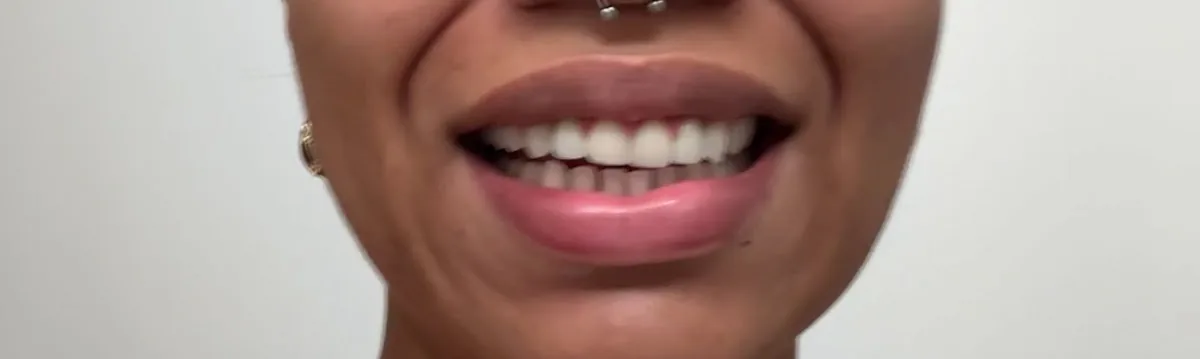 Beautiful Smiles - North Miami photo 3