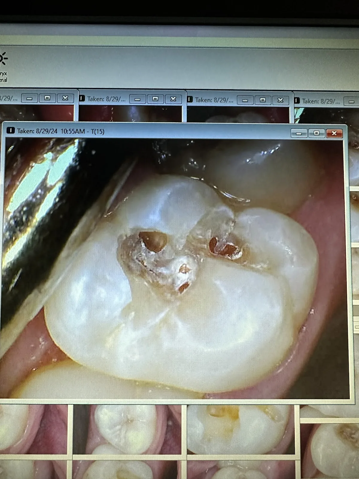 Dr. Abraham Jaskiel, DMD Dentist photo 4