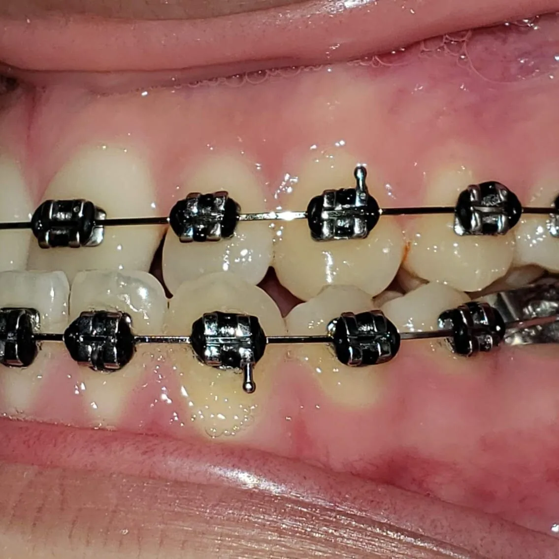 Dr. Dora R. Artiles: Art Dental Clinic photo 5