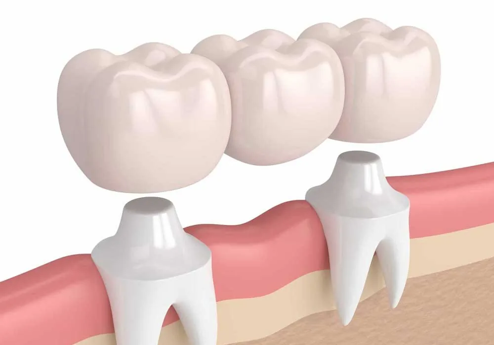 Dr. Javier Cutino - Emergency Dentist photo 4