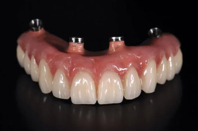 Dr. Javier Cutino - Emergency Dentist photo 5