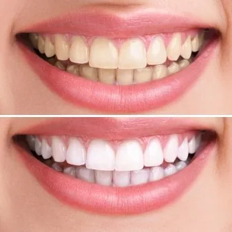 Gables Dental Care photo 4