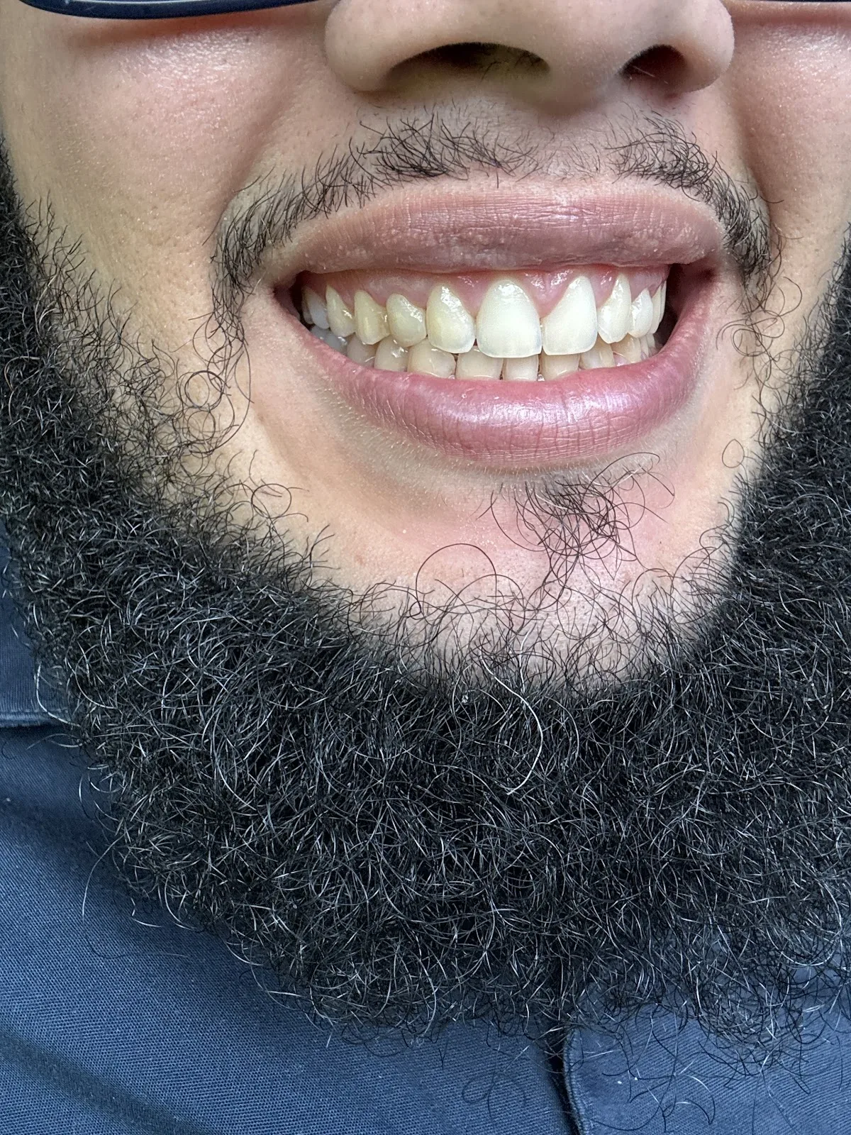 Gables Family Dental of Allapattah photo 5