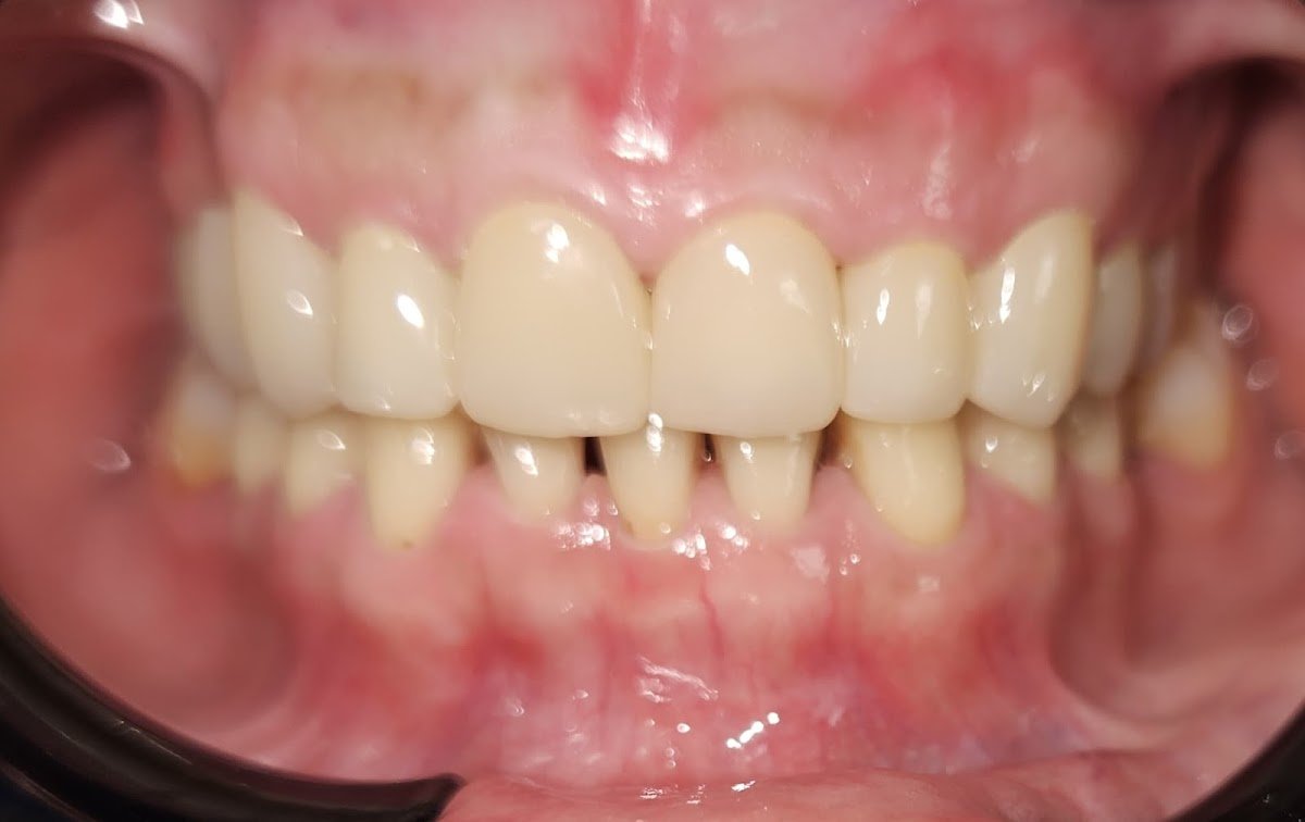 Garmen Dental Care photo 5