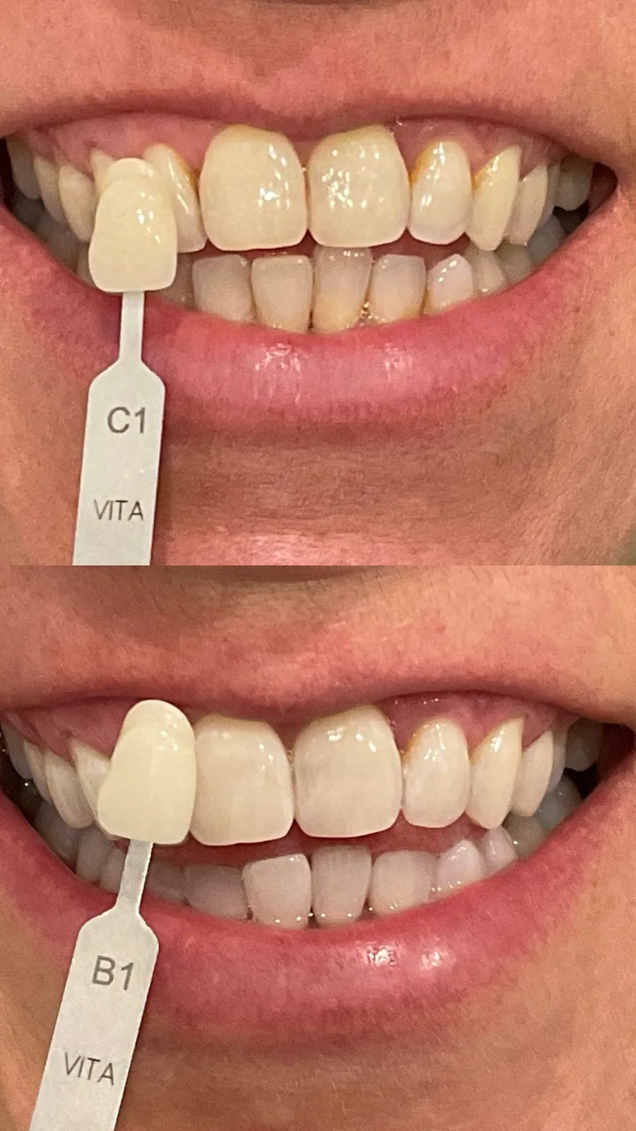 International Dental Clinic photo 4