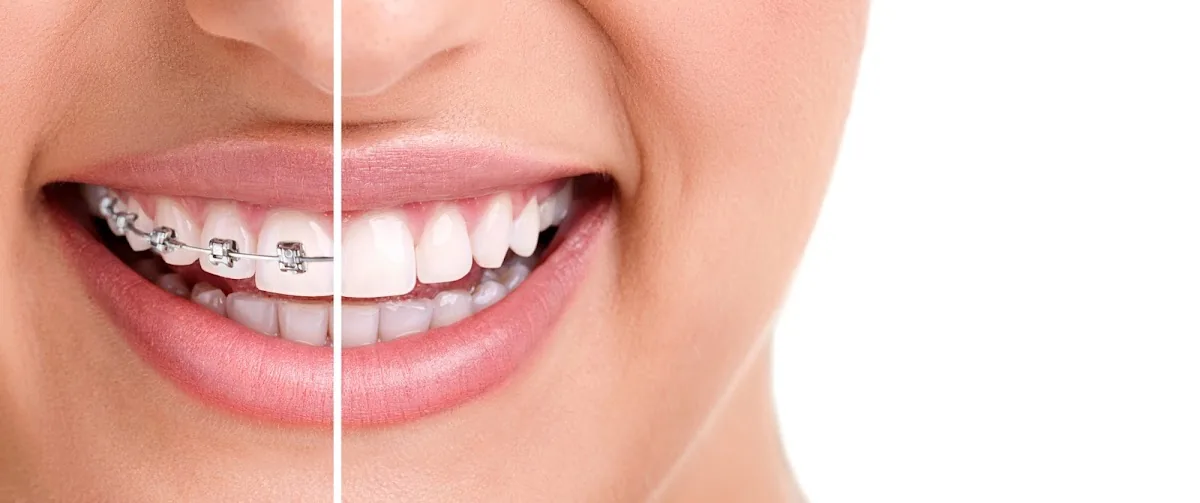 Miami Beach Orthodontics photo 2