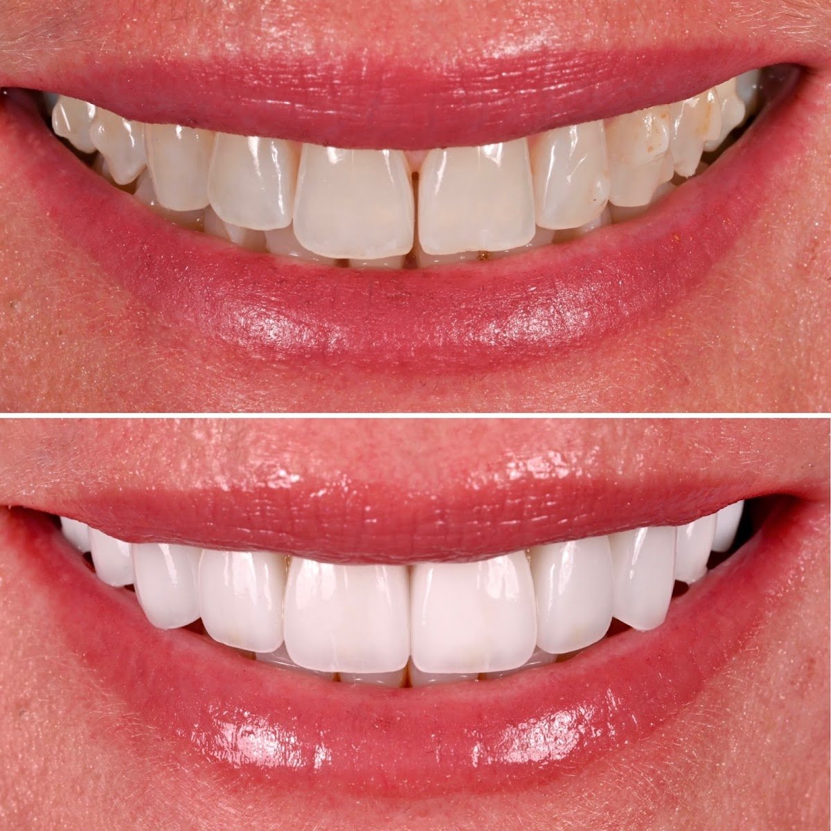 Ressler, Hirschl & Lelchuk DDS PA photo 2