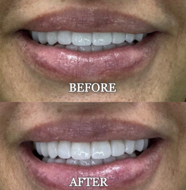 Vasallo Dental Office PA photo 3