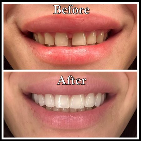 Vasallo Dental Office PA photo 4