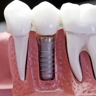 Bellevue Dental Care photo 3