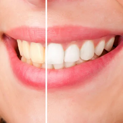 Bellevue Dental Care photo 2