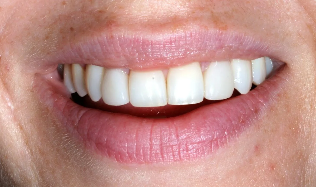 Dasling Dentistry photo 4