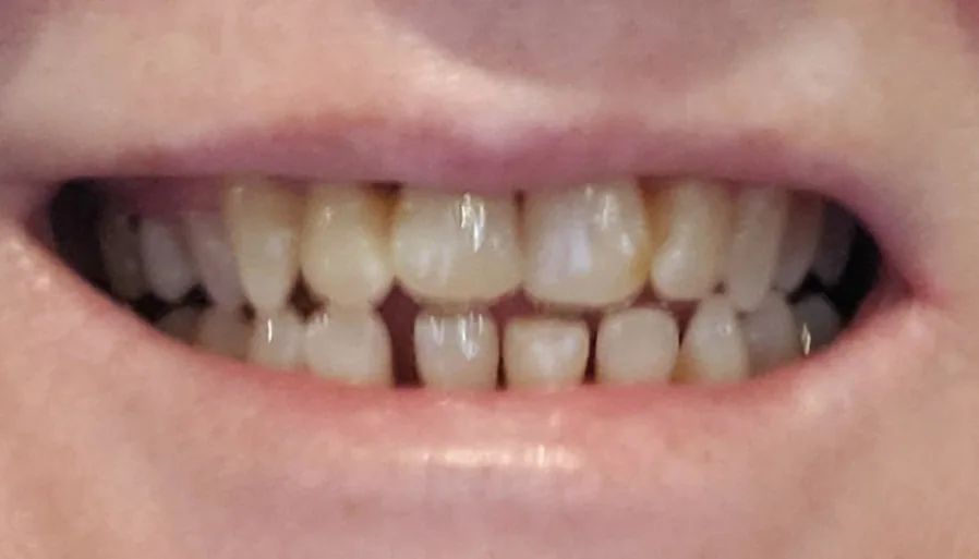 Dentistry of the Carolinas - East Charlotte photo 4