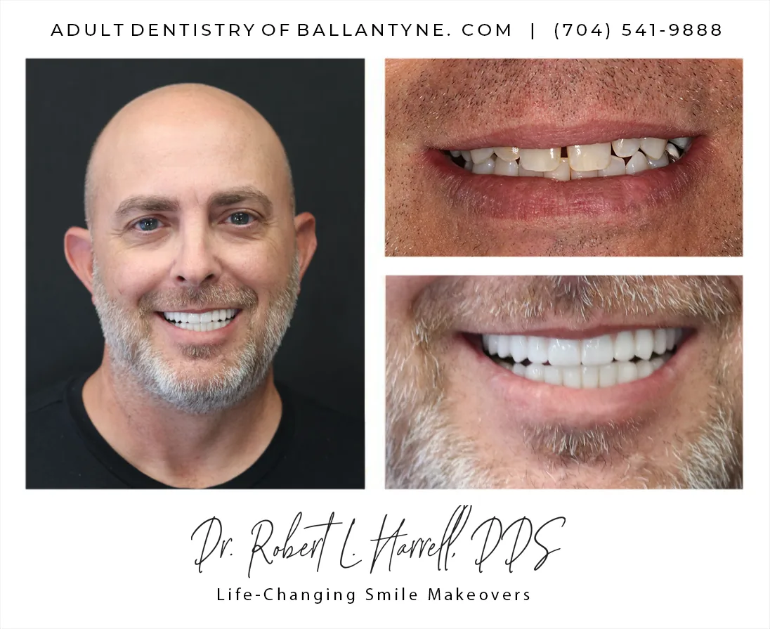 Dr. Robert L. Harrell, DDS photo 3