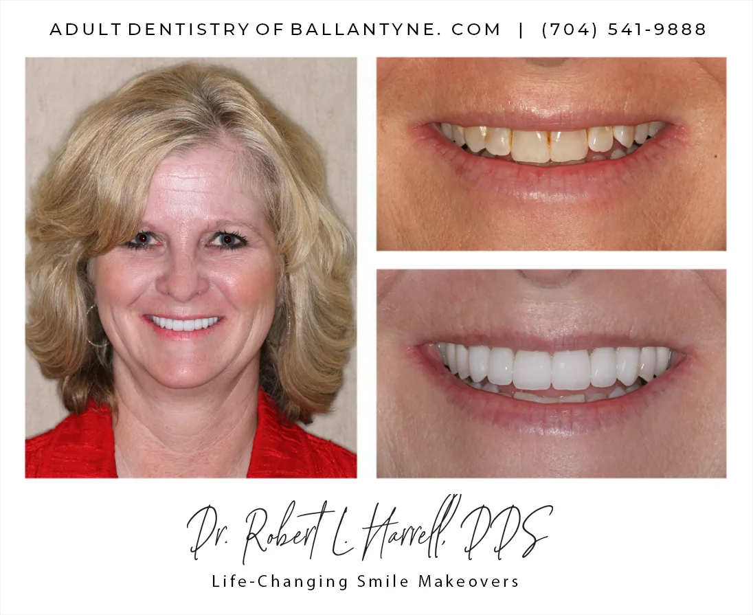Dr. Robert L. Harrell, DDS photo 5