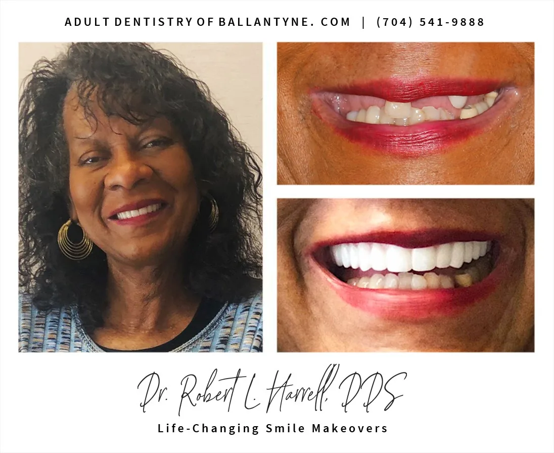 Dr. Robert L. Harrell, DDS photo 4