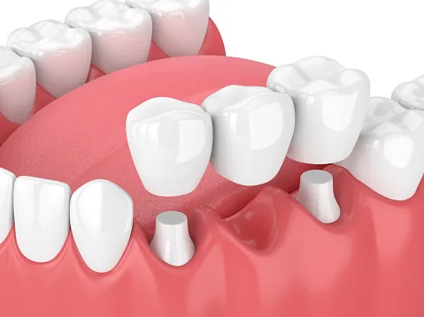 Myers Park Dental Partners photo 6