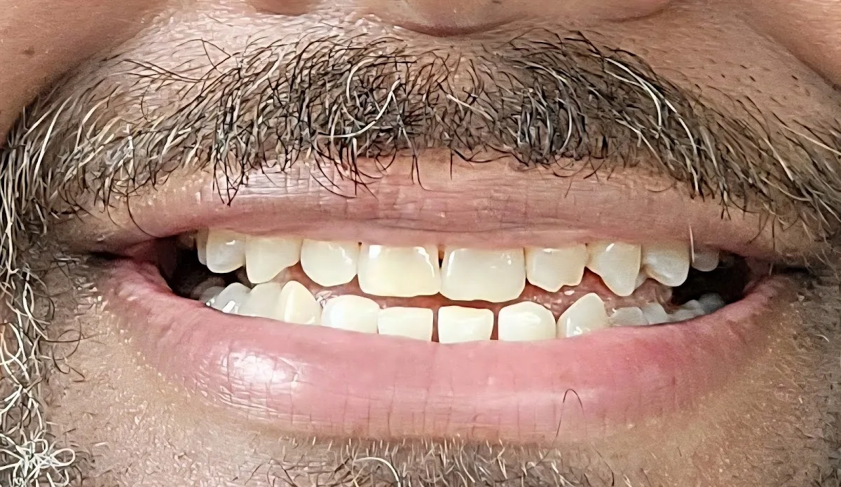 Oasis Dentistry - Charlotte photo 3