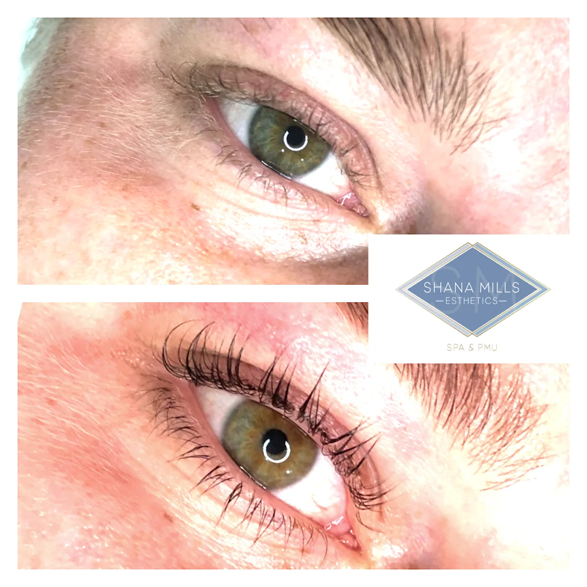 Shana Mills Esthetics photo 5