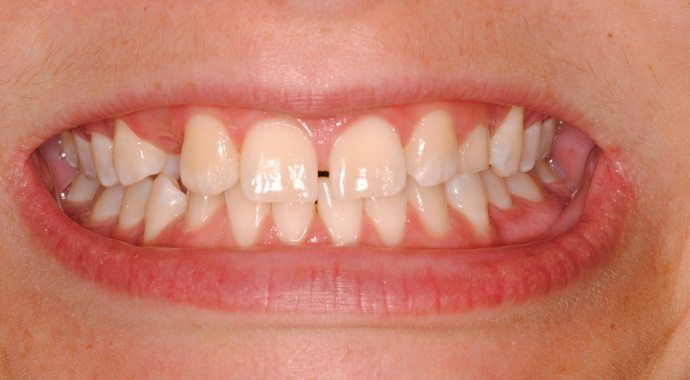 The Maryland Center for Complete Dentistry: Jonathan E. Silverman, DDS photo 1