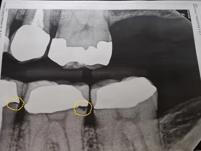 Dental Care of Westminster photo 6