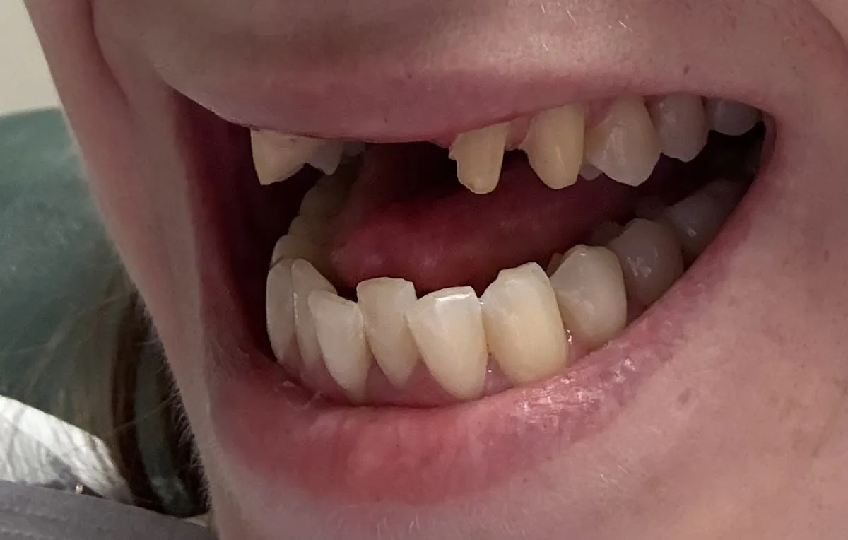 Dental One Associates of Westminster photo 4