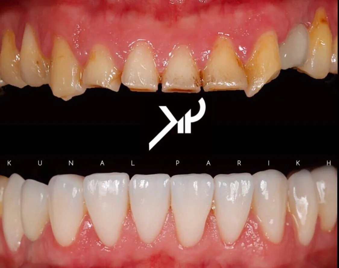 Kunal Parikh, DMD: Dentist Philadelphia photo 3