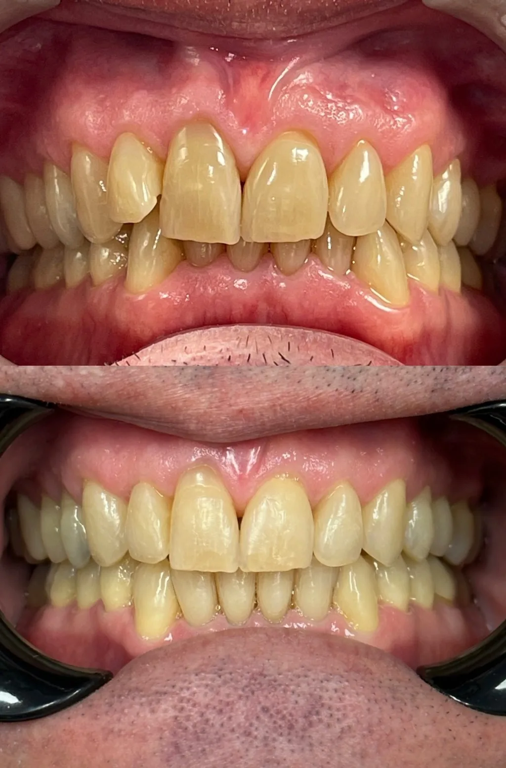 Apex Family Dental PC photo 3