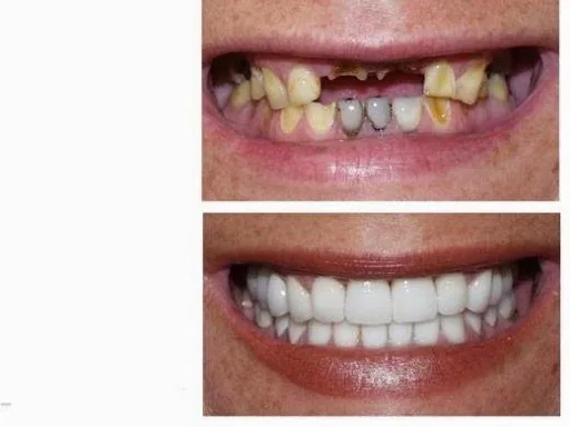 Brooklyn Dental photo 3