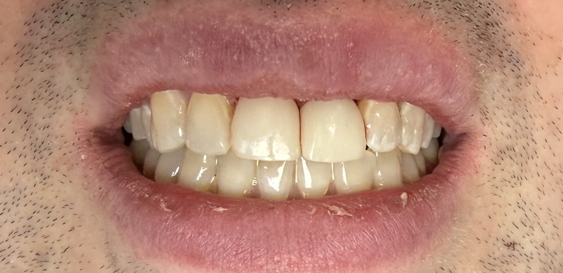 Dentist in Tribeca: Paolo Saggese, DMD, PLLC photo 4