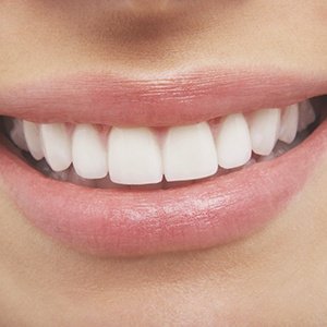 DPI Dental: Paul Ilan, DDS photo 4