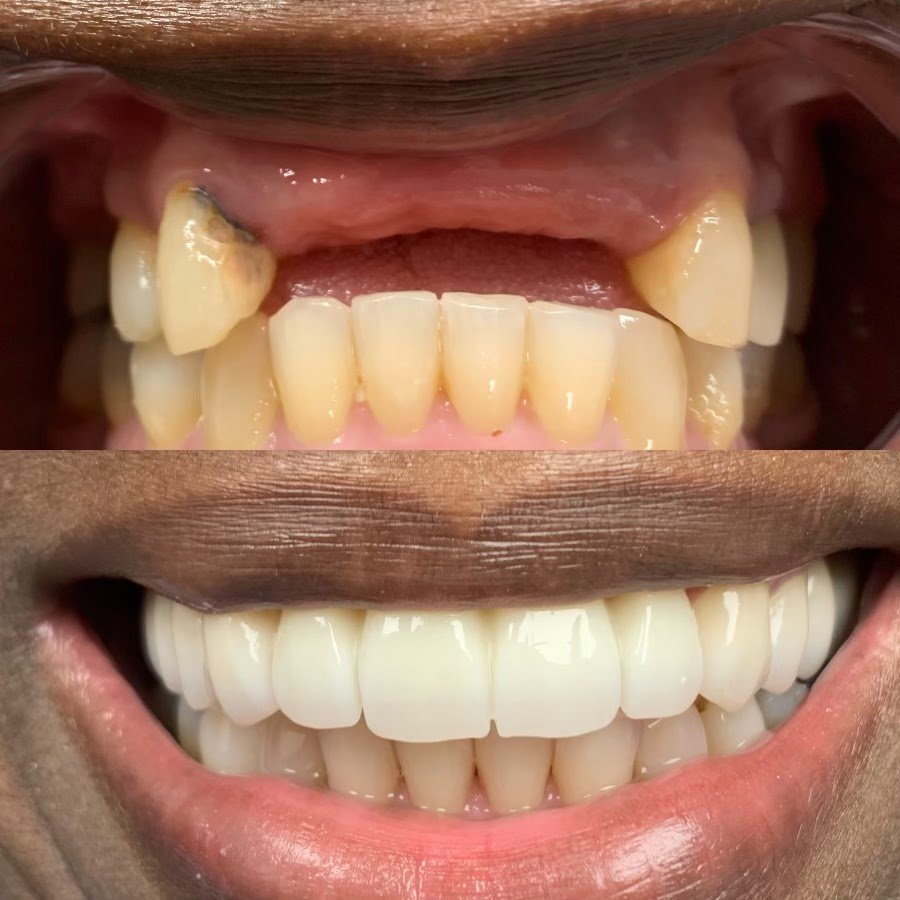 DPI Dental: Paul Ilan, DDS photo 5