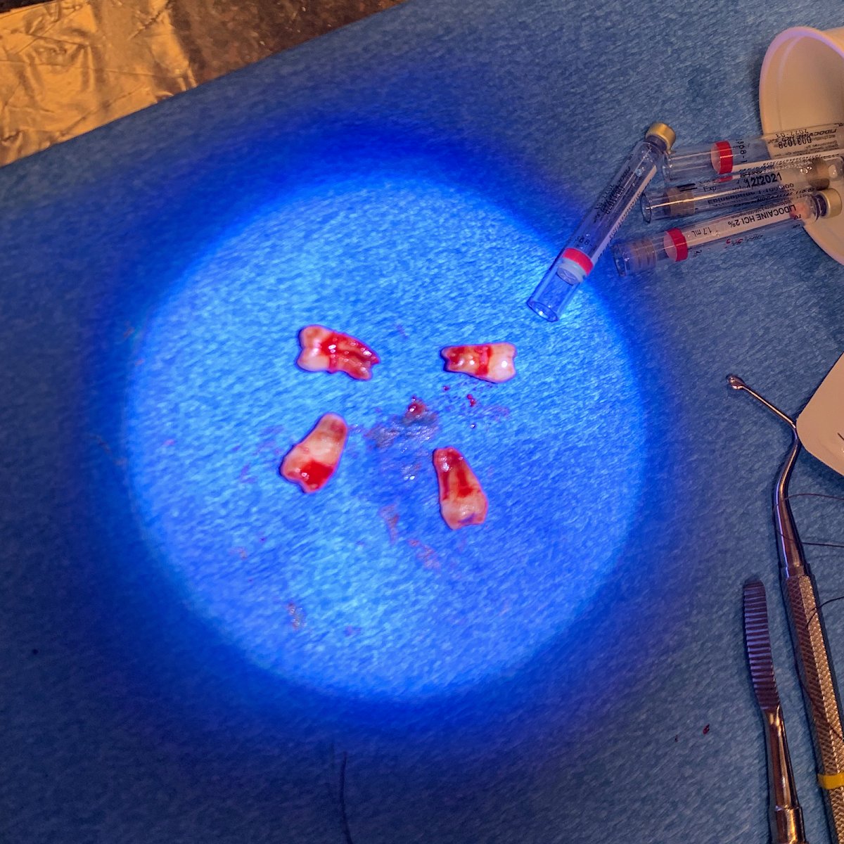 Emergency Dentist NYC photo 4