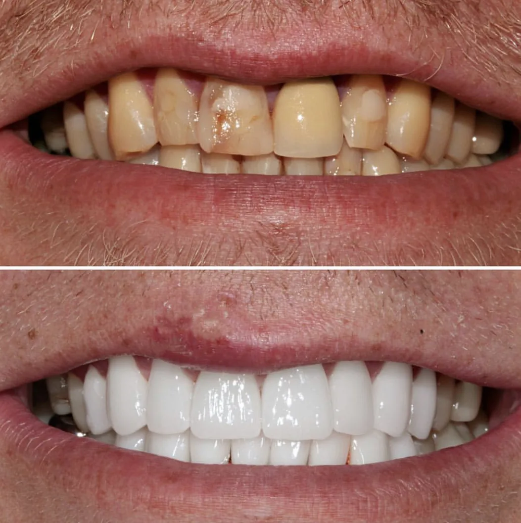 New Leaf Dental - Brooklyn, NY photo 6